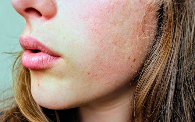 sensitive skin or allergies